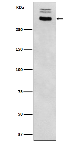 Thyroglobulin Ab