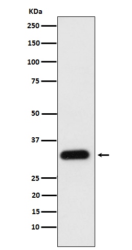 Apolipoprotein F Ab