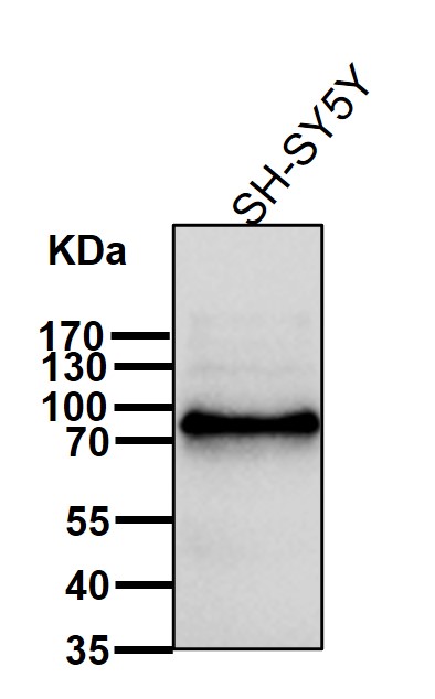 p90 S6 kinase alpha 6 Ab