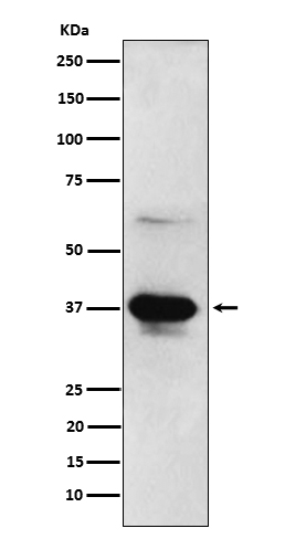 DFF45 Ab