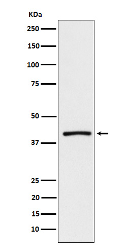 ATP1B3 Ab