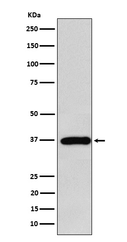 FBPase 1 Ab