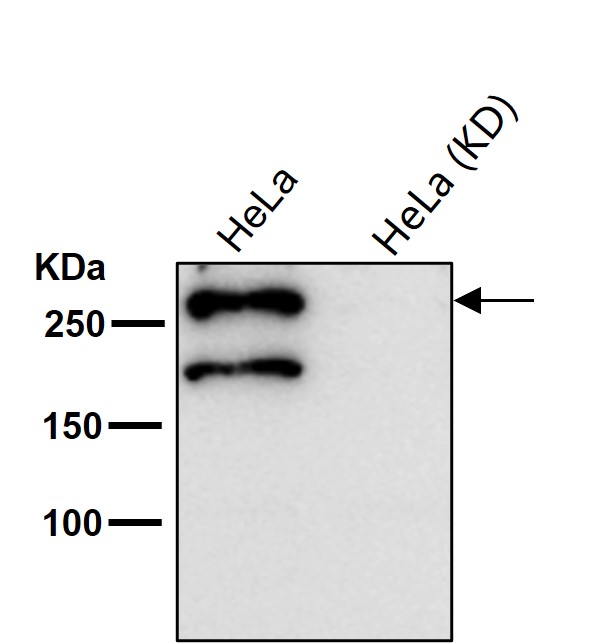 Desmoplakin Ab