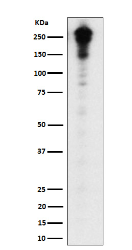 Desmoplakin Ab