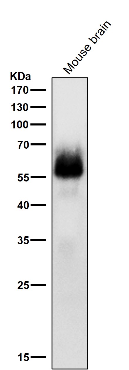 p-Chk2 (S33/S35) Ab