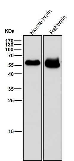 IRF4 Ab