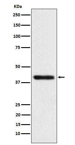 Tropomodulin 2 Ab