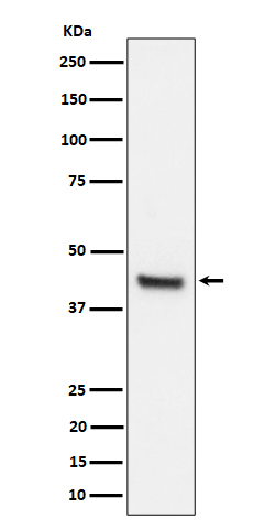 IL 11 receptor alpha Ab