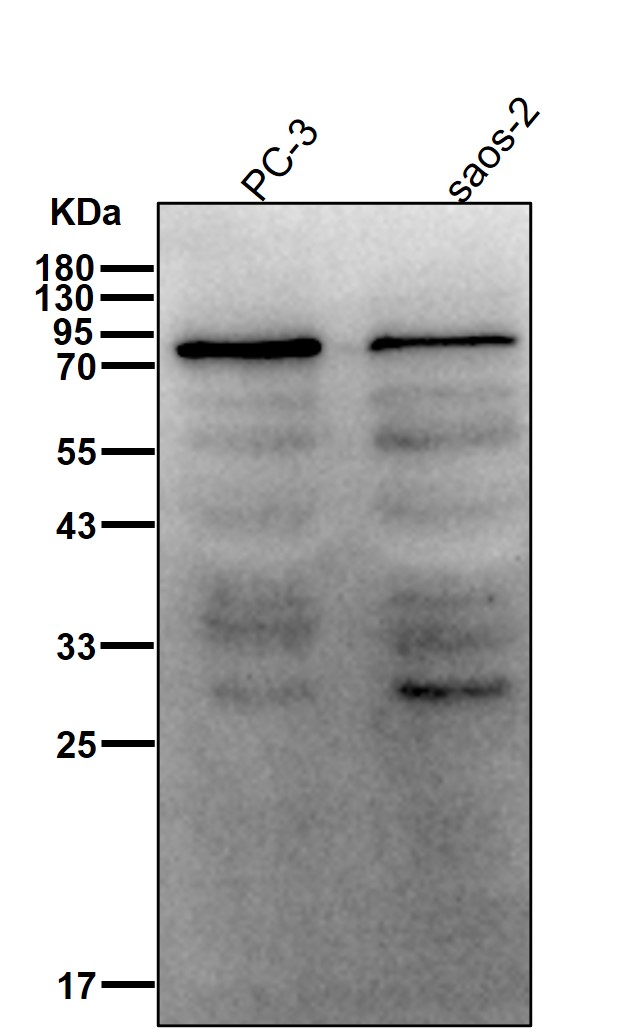 p-beta Catenin (T41/S45) Ab