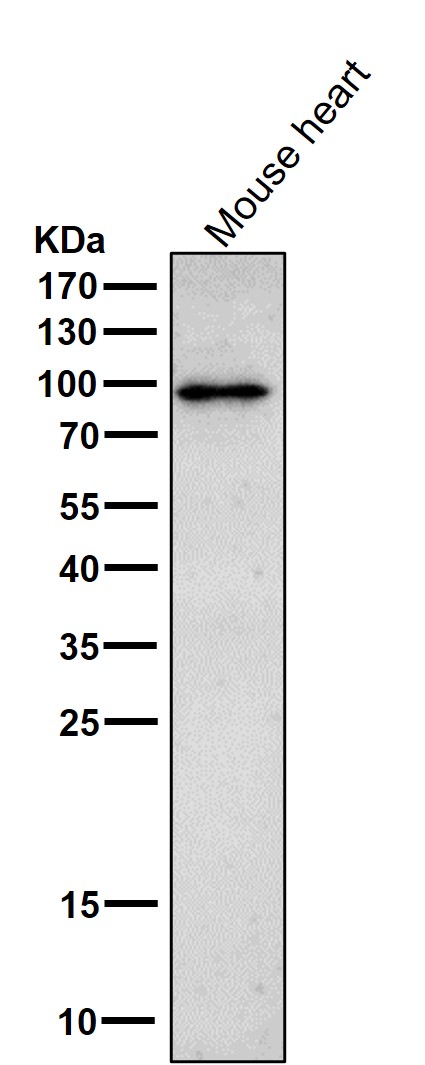 p-beta Catenin (T41/S45) Ab