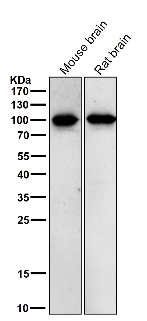 p-beta Catenin (T41/S45) Ab