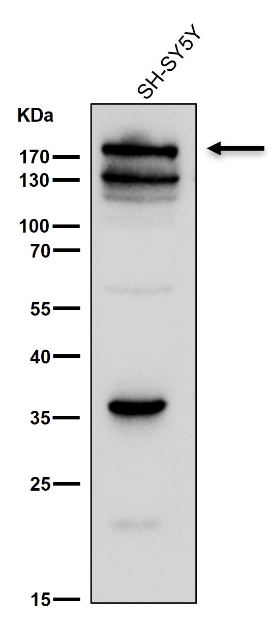 p-Tuberin (S939) Ab