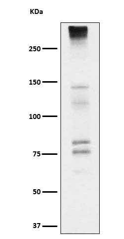 Neurocan Ab