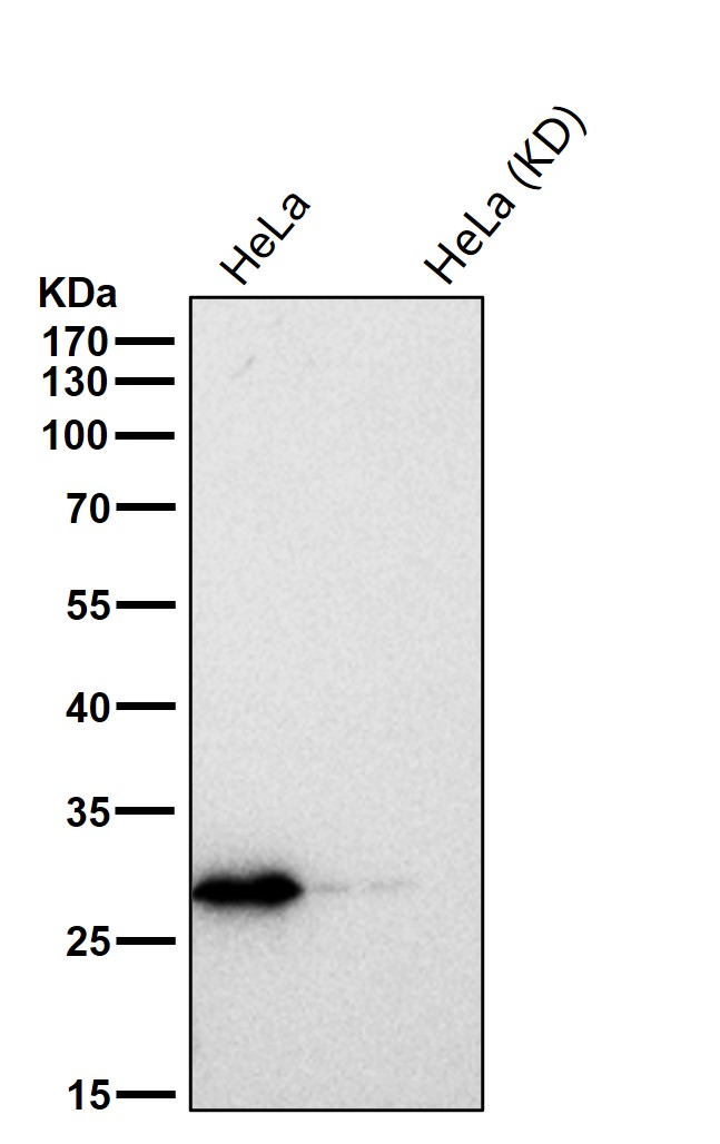 CHMP2B Ab