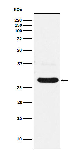 CHMP2B Ab