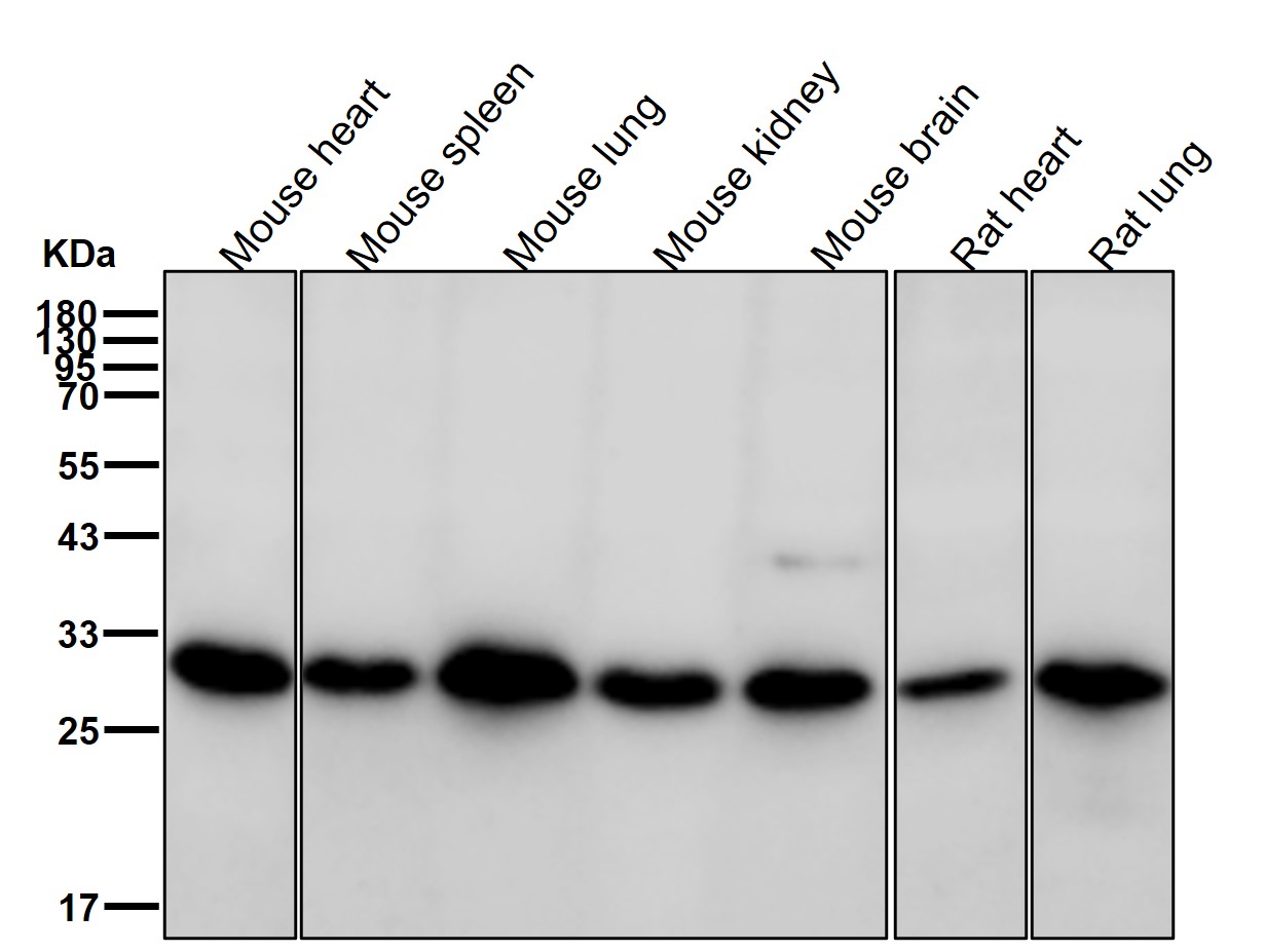 CHMP2B Ab