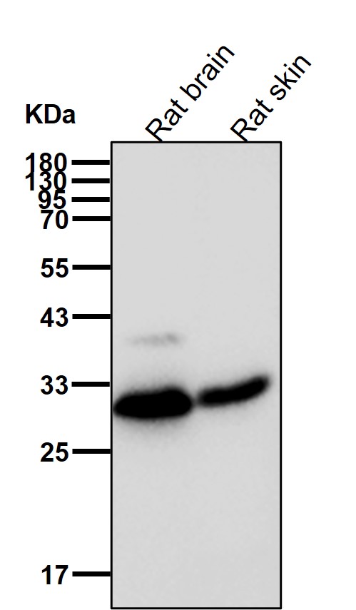 CHMP2B Ab