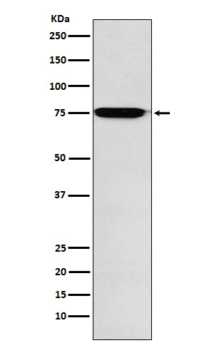 Lysosomal alpha glucosidase Ab