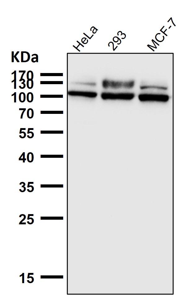 Lysosomal alpha glucosidase Ab