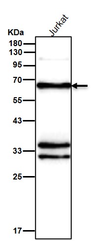 Epitempin 1 Ab