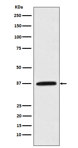 Kallikrein 5 Ab