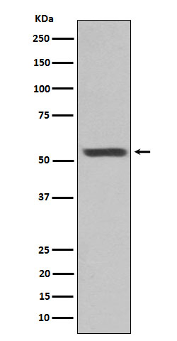 Cytokeratin 12 Ab