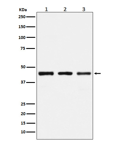 PGD Ab