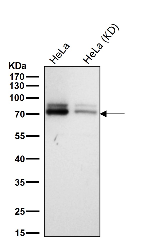 ACSL4 Ab