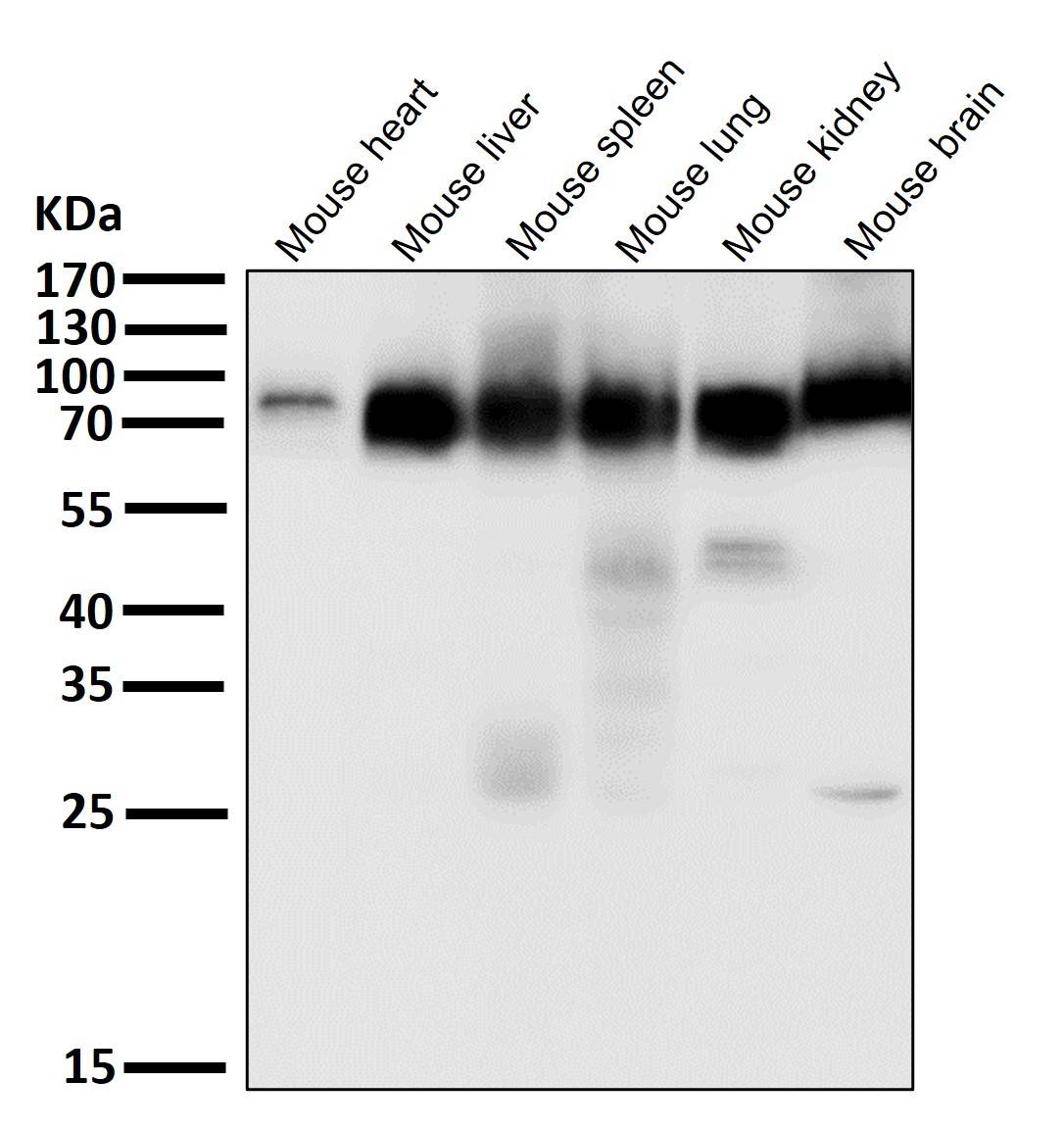 ACSL4 Ab