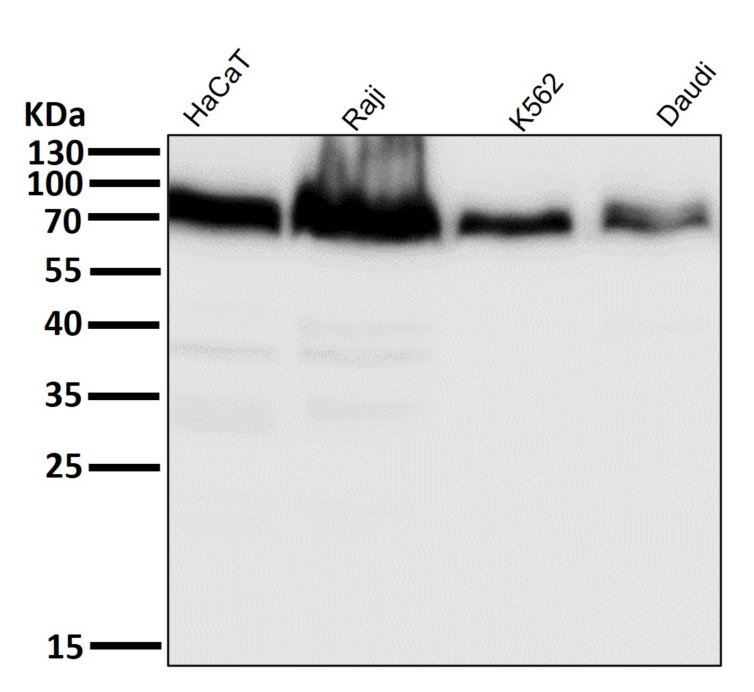 ACSL4 Ab