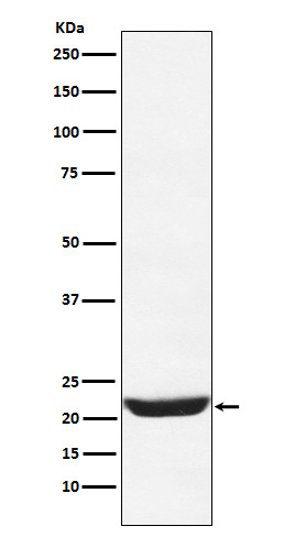 NCS 1 Ab