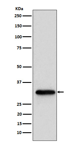 NUDT5 Ab