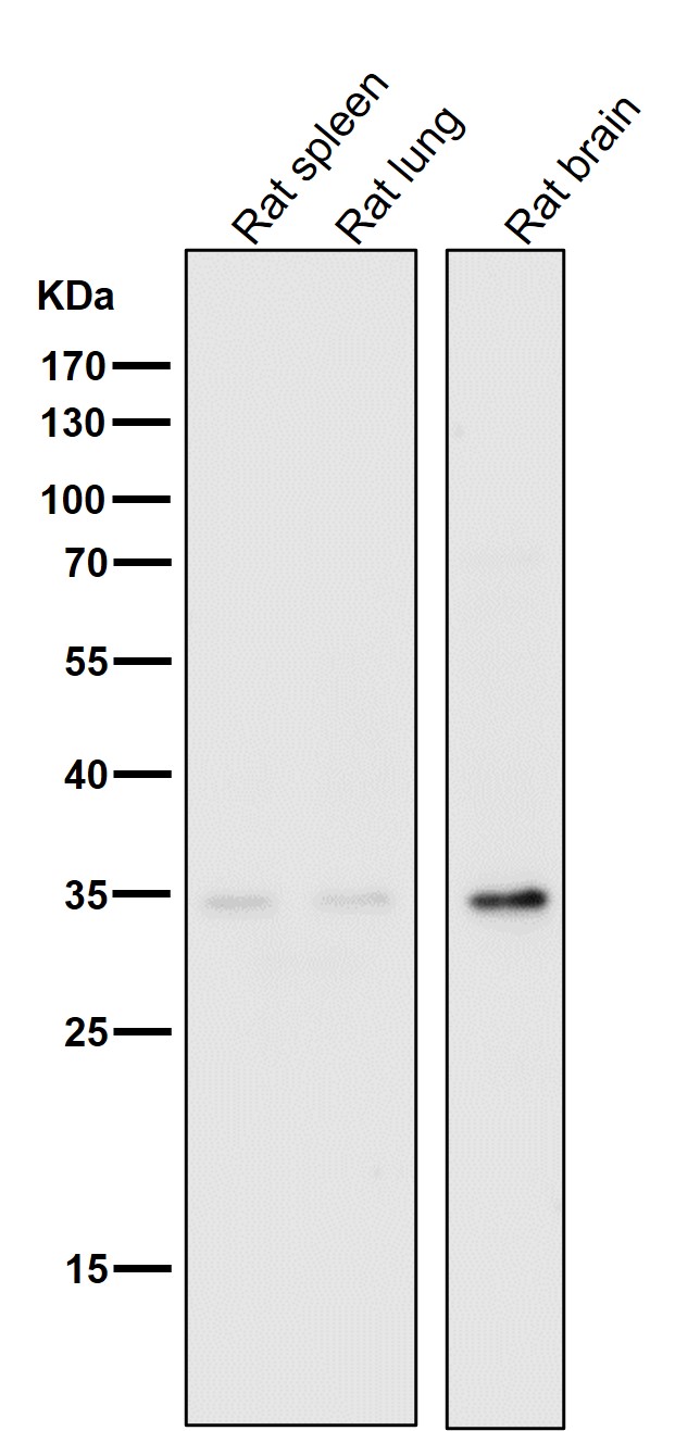 NUDT5 Ab