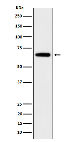 IGF2BP2 Ab