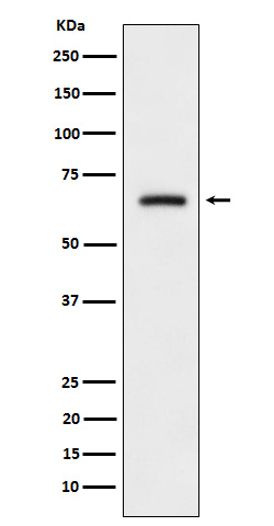 DRP 4 Ab