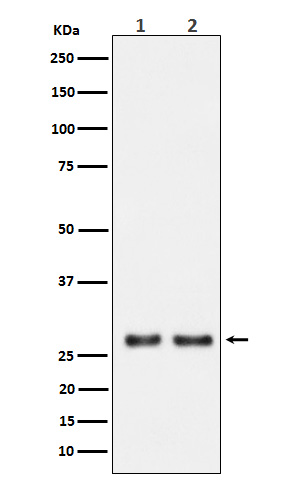 Uridine phosphorylase 1 Ab