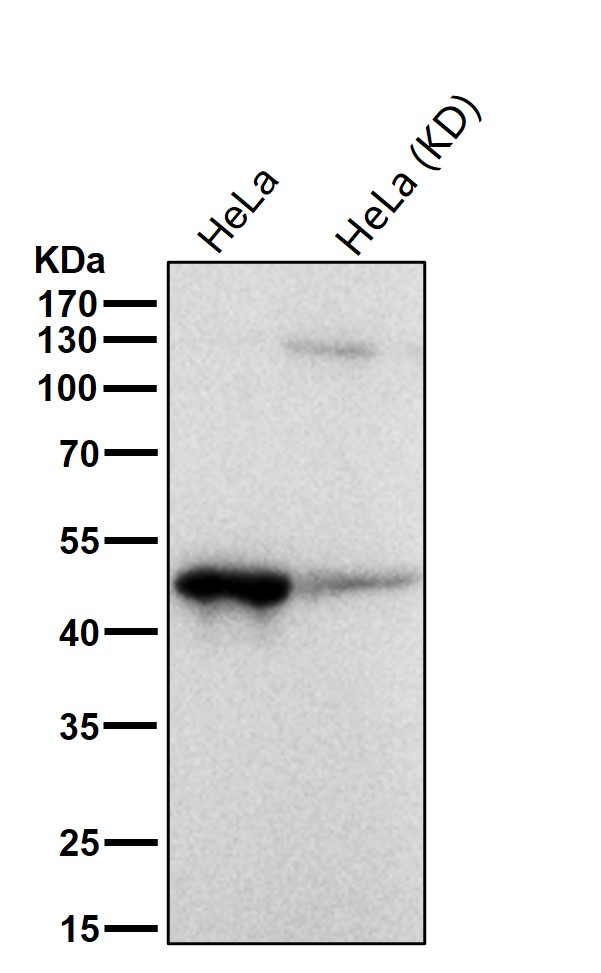 ACAA2 Ab