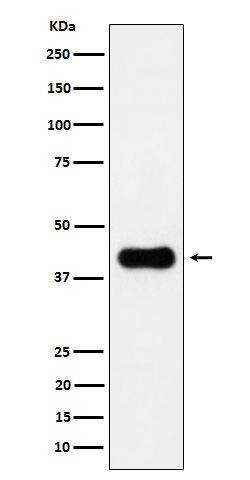 ACAA2 Ab