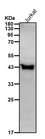 ACAA2 Ab