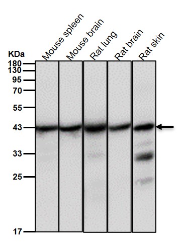 ACAA2 Ab