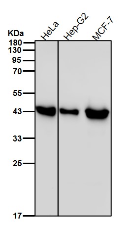 ACAA2 Ab