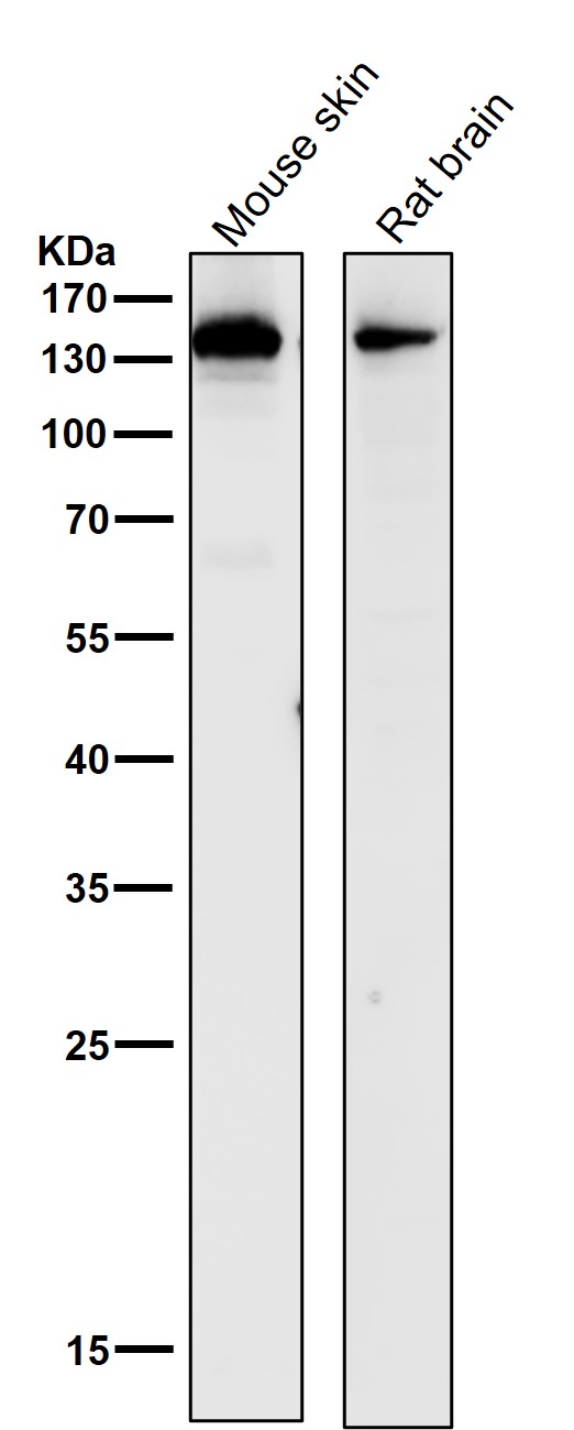 Collagen III alpha 1 Ab