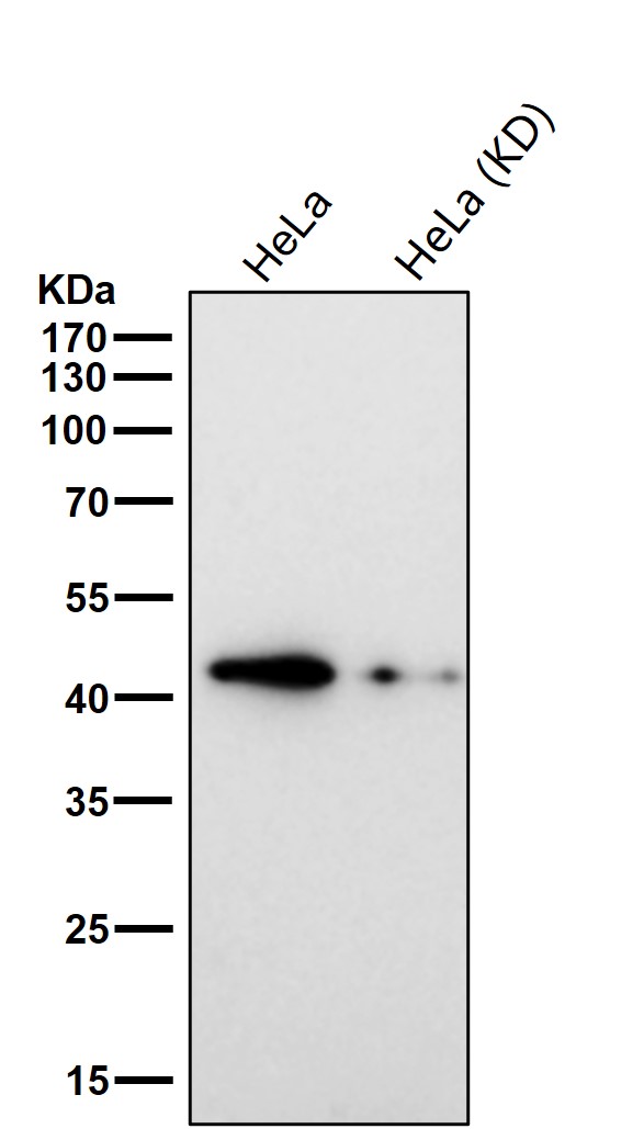 TDP43 Ab