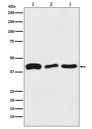 TDP43 Ab