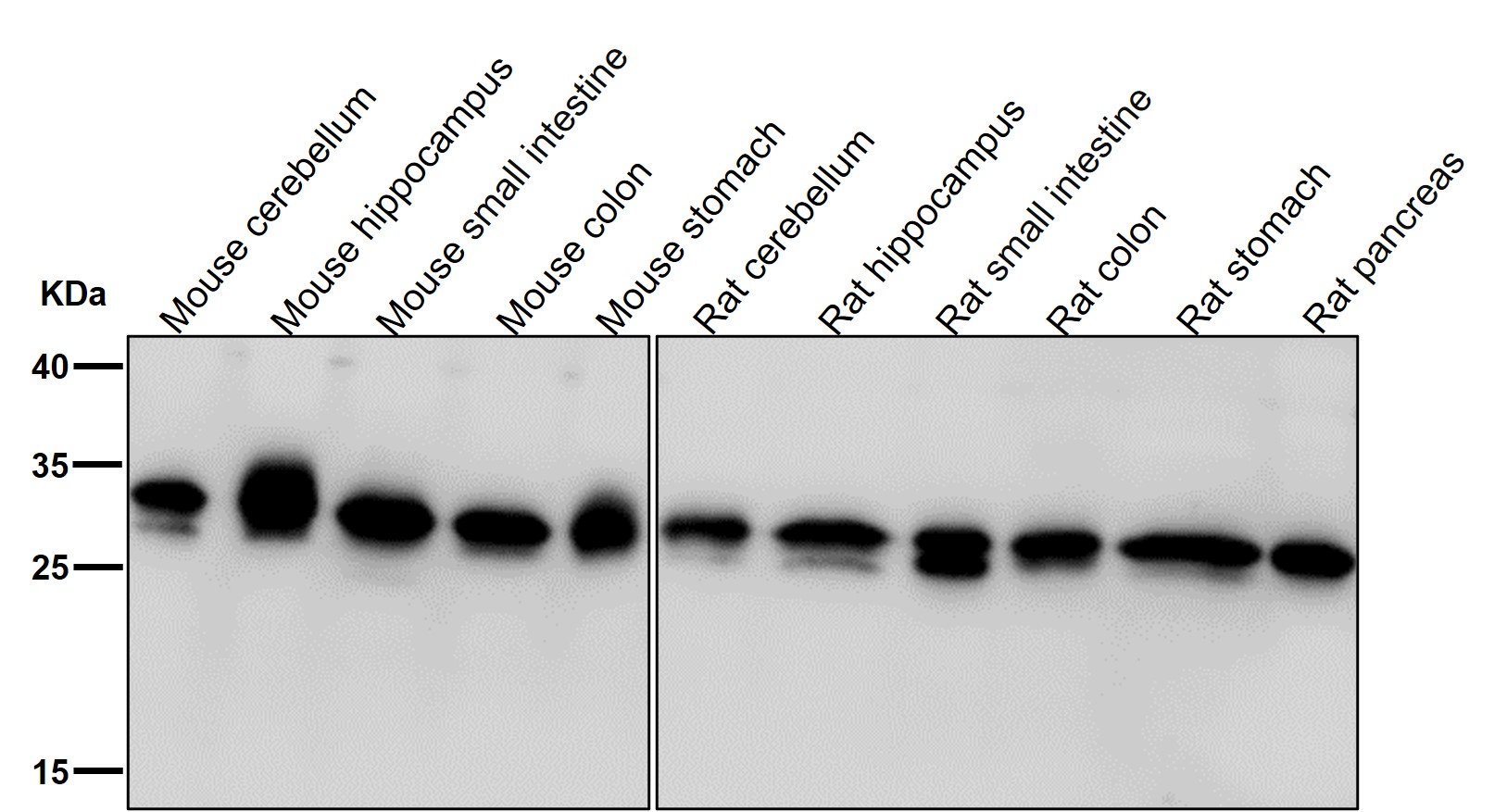 PHD3 Ab