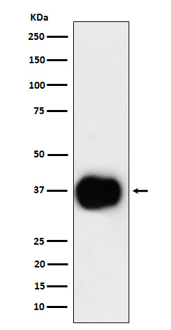 CD79b Ab