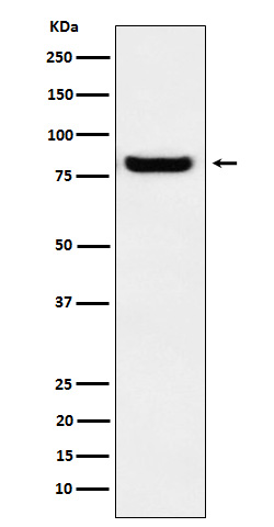 Glucosidase 2 beta Ab