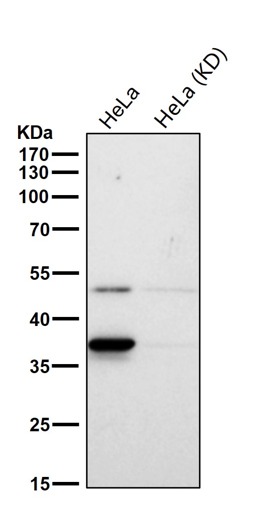 ACAT2 Ab