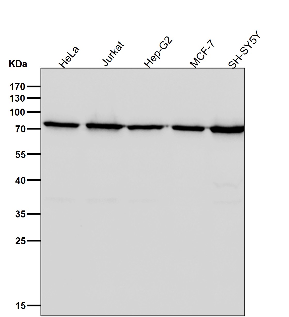 CPSF73 Ab