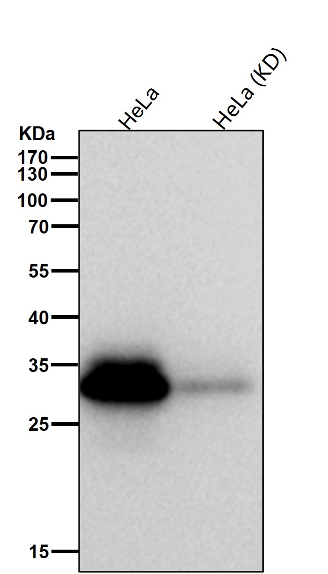 Complement C1q binding protein Ab